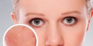 Deshidratarea tenului – cauze si solutii