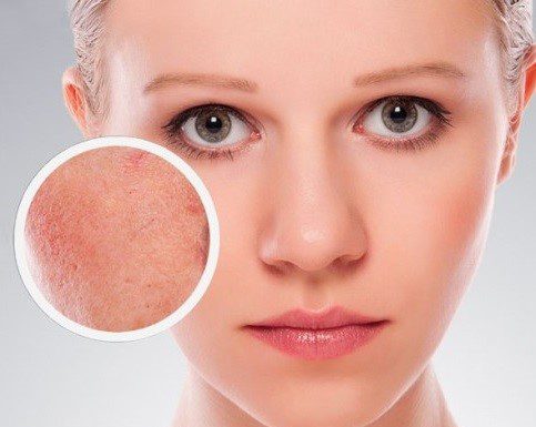 Deshidratarea tenului – cauze si solutii