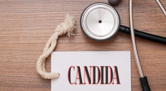 5 remedii naturiste pentru a trata candidoza